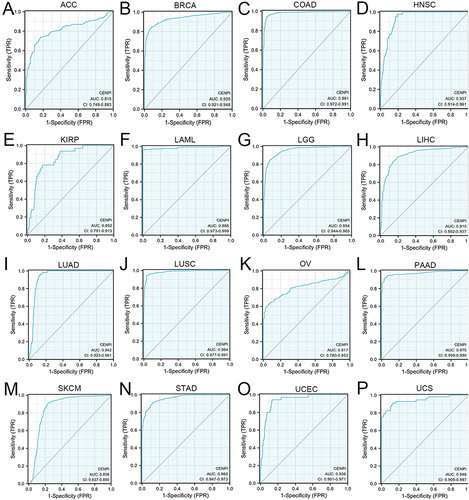 Figure 3 Receiver operating characteristic (ROC) curve of CENPI expression in pan-cancer. (A) ACC; (B) BRCA; (C) COAD; (D) HNSC; (E) KIRP; (F) LAML; (G) LGG; (H) LIHC; (I) LUAD; (J) LUSC; (K) OV; (L) PAAD; (M) SKCM; (N) STAD; (O) UCEC; (P) UCS.