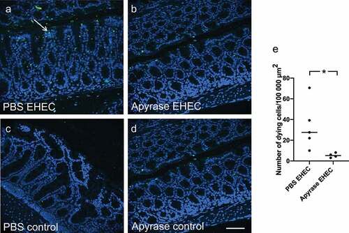 Figure 6. Intestinal apoptosis in mice infected with E. coli O157:H7. TUNEL-positive cells were assessed in mouse colons 2 days after inoculation with E. coli O157:H7 before the development of symptoms. a) Colon from a mouse inoculated with E. coli O157:H7 and treated with vehicle exhibited apoptotic cells (white arrow, green labeling) close to the lumen. b) Colon from an infected mouse treated with apyrase showed minimal TUNEL-positivity. c) Uninfected control mouse treated with vehicle. d) Uninfected control mouse treated with apyrase. e) Number of TUNEL-positive cells/100,000 μm2 in E. coli O157:H7-infected mice treated with vehicle (PBS) (n = 5) or apyrase (n = 4). The bar represents the median. Green: TUNEL positive cells; blue: DAPI: 4',6-diamidino-2-phenylindole. * P < 0.05, two-tailed Mann-Whitney U test. Scale bar 100 μm.