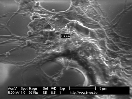 Figure 9. SEM picture of the neuronal cell membrane engulfing PA22-2 coated particles. The arrow points towards an apparently partial engulfed particle.