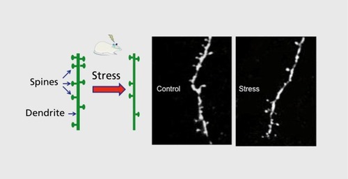 Figure 1. Chronic stress causes neuronal atrophy: a decreased number of spine synapses. Basic research studies demonstrate that repeated stress causes atrophy of neurons in the prefrontal cortex and hippocampus of rodents. Shown on the left is a diagram of a segment of a dendrite that is decorated with spines, and the reduction in spine number after exposure to repeated stress. On the right are examples of two photon laser microscopy images of neurobiotin-labeled dendrites from layer V pyramidal neurons in the prefrontal cortex of rats housed under control conditions or after exposure to immobilization stress (7 days, 45 minutes per day).