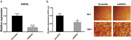 Figure 1. Knockdown of NSDHL decreased lipid accumulation in 3T3-L1 differentiated adipocytes.