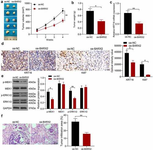 Figure 6. BARX2 impedes the growth and metastases of NPC cells in vivo. (a) changes in tumor volume in mice examined using in vivo tumorigenesis assay. (b) assessment of cellular tumorigenic capacity by tumor weight change. (c) mRNA expression of KRT16 in tumor tissues by RT-qPCR. (d) immunohistochemical analysis of KRT16 and ki67 in tumor tissues. (e) protein expression of pMEK1, MEK1, p-ERK1/2 and ERK1/2 in tumor tissues examined using Western blot. (f) lung infiltration of tumor cells examined using HE staining. Results are shown as mean ± SD (n = 5). The unpaired t-test and two-way ANOVA was utilized for statistical analysis. *p < 0.05, **p < 0.01 vs oe-NC.