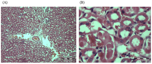 Figure 8. Photomicrographs from the kidney of (A) control and (B) treated rats at dose 5000 mg/kg. There were no adverse histopathological conditions observed in the kidney of the control and treatment groups. The kidney for the treatment group appeared normal with preserved internal architecture.