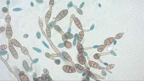 Figure 2 Microscopic examination of the colonies: pigmented septate hyphae with chains of ovate conidia with transverse and vertical septa.