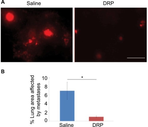 Figure 3 Effect of DRP on experimental metastasis of MDA-231 cells in lungs.