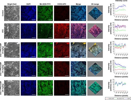 Figure 11 Immunofluorescence images demonstrating the expression of Mn-SOD and COX2. Slides were viewed using a confocal microscope (magnification 20×). Respective fluorescence intensities (Mn-SOD-FITC, COX2-APC, and DAPI) were analyzed using ImageJ software through RGB calculator.Abbreviations: APC, allophycocyanin; RGB, red-green-blue; SOD, superoxide dismutase.