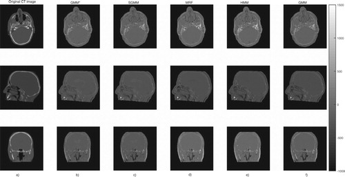 Figure 6. The first column (a) presents the original CT image slices and the remaining columns (b)–(f) show the prediction errors for each model.