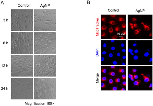 Figure 7. AgNP changed the mitochondrial morphology. (A) AgNP-induced changes in cells were observed over time using a phase-contrast microscope (magnification 100×). (B) Changes in mitochondria morphology were observed using MitoTracker™ Red FM and DAPI staining. Confocal microscopic image showed the mitochondrial (red), nucleus locations (blue), and the merged image indicated the mitochondria localization.