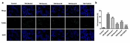 Figure 2. Effects of dendrobine on apoptosis. (a and b) Results of TUNEL staining for apoptosis. ***P < 0.001 Vs Control, ###P < 0.001 Vs TM (Model), $$$P < 0.001 Vs TM+Dend-L, &&&P < 0.001 Vs TM+Dend-M, @@@P < 0.01 VS TM (Model)