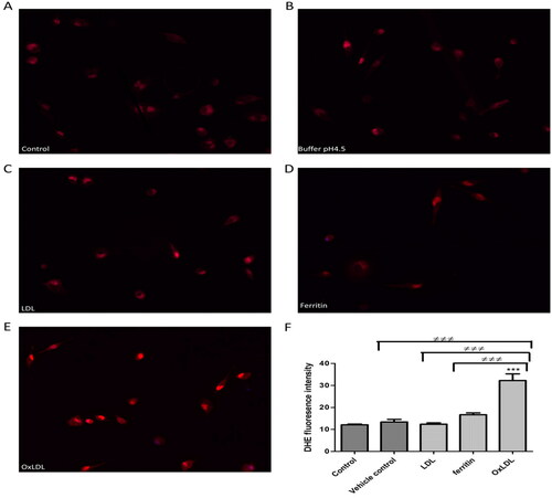 Figure 4. Effect of ferritin-oxidized LDL on intracellular reactive oxygen species formation by THP-1 macrophages. Cells (45,000) were plated on cover slips and incubated for 24 h in (A) RPMI 1640 medium, serum, and antibiotics alone or containing (B) sodium acetate buffer, pH 4.5 (10% (v/v) as a vehicle control, (C) native LDL (50 µg protein/ml), (D) ferritin (44 µg/ml; 0.1 µM), or (E) ferritin-oxidized LDL (50 µg protein/ml). The cells were then washed with PBS and incubated with 10 µM DHE for 30 min in the dark at 37 °C in an incubator without CO2, washed with PBS and mounted using fluorescence mounting medium containing DAPI. (F) The fluorescence intensity was measured with an epifluorescence microscope. The control cells were not exposed to acidic buffer, LDL or ferritin. ***p < 0.001 compared with the control cells. ≠≠≠p < 0.001 for the indicated comparison for three independent experiments.