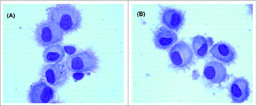 Figure 1. Zoledronic acid treatment does not modify the morphology of monocyte-derived DCs. Mature DCs were differentiated from untreated (A) and ZA-treated (B) CD14+ cells from melanoma patients. DC preparation was examined by light microscopy after May–Grunwald-Giemsa staining. A representative experiment using the cells from a patient in stage III of the disease is shown. DCs, dendritic cells; ZA, zoledronic acid.
