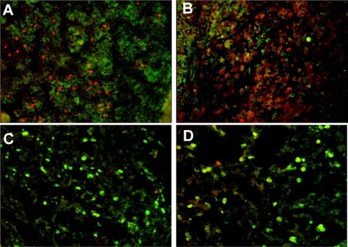 Figure 10 Immunofluorescence images of inguinal lymph nodes of (A) interferon (IFN)-γ-positive CD8+ T cells in mice immunized with small tetanus toxoid-loaded poly-ε-caprolactone nanoparticles and (B) interleukin (IL)-4-positive CD8+ T cells. (C and D) Negative controls. CD8 is tagged with fluorescein (green), IFN-γ and Il-4 with phycoerythrin (red). Magnification 200×.