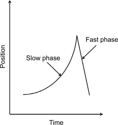 Figure 1 Waveform showing the initiation (slow) phase and correction (fast) phase of a jerk nystagmus cycle.