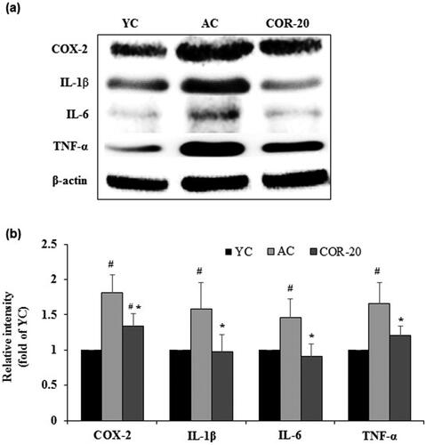 Figure 2. Effect of COR on protein expression levels of inflammatory markers. (a) Protein expression of COX-2, IL-1β, IL-6, and TNF-α in YC, AC, and COR-20 groups analyzed by Western blotting in rat testis tissue; (b) Relative intensity levels (fold) in three independent experiments, respectively. β-Actin was used as an internal control. The data are expressed as the mean ± SD. #p < 0.05 compared with YC and *p < 0.05 compared with AC group. COX-2: cyclooxegenase-2, IL: interleukin, TNF-α: tumor necrosis factor-α, YC: young control, AC: aged control, COR-20: aged rats plus cordycepin 20 mg/kg treated group.