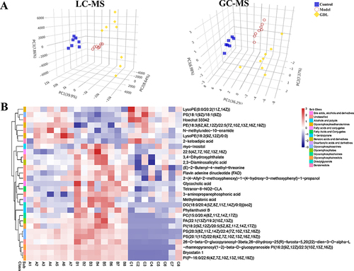 Figure 2 (A) PLS-DA score plots of three groups by LC-MS and LC-MS. (B) Hierarchical clustering analysis heatmap of differential metabolites in copper-laden WD rats treated by GDL. Red and blue represent that the levels of differential metabolites are higher and lower compared to the average level, respectively.