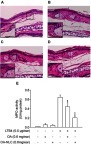 Figure 9 Effects of OA and OA-NLC on LTB4-induced skin inflammation.Notes: OA or OA-NLC were applied topically to ear of the mice, followed by the topical application of LTB4 (0.5 μg/mL, in ethanol). Skin inflammation was characterized by epidermal neutrophil infiltration, which was alleviated by OA and OA-NLC. Representative histology images from six independent experiments are shown. Magnification, 400×; inset, 800×, Scale bar represent 50 μm; 25 μm (A) sham-operated mice. (B) Mice with LTB4-induced skin inflammation. (C) Mice with LTB4-induced skin inflammation pretreated with OA. (D) Mice with LTB4-induced skin inflammation pretreated with OA-NLC. (E) Administration of OA and OA-NLC suppress MPO activity, which had a significantly increased in inflamed skin induced with LTB4. Data are expressed as the mean ± standard error of the mean, n=6, **P<0.01, ***P<0.001, as compared to the control assay.