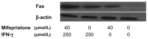 Figure 4 Cell expression of Fas detected by Western blot.