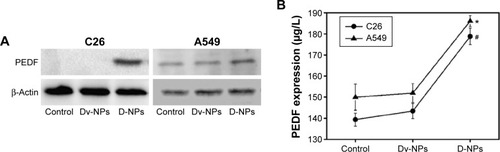 Figure 6 In vitro expression of PEDF in C26 and A549 cells treated by D-NPs and Dv-NPs for 48 hours, respectively.Notes: (A) Western blot analysis for the detection of PEDF expressed in tumor cells. (B) ELISA analysis for the measurement of PEDF secreted into the extracellular environment. # and *represent the statistically significant difference versus respective control and Dv-NPs in C26 and A549 cells (P<0.01).Abbreviations: CPPC, COOH-PEG-PLGA-COOH; D-NPs, PEDF gene loaded CPPC nanoparticles; PEDF, pigment epithelium-derived factor; Dv-NPs, null plasmid loaded PEG-PLGA nanoparticles.