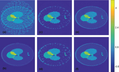 Figure 8. Reconstruction results for a Shepp–Logan type phantom from data with 2% Gaussian noise added (all images are displayed using the same colourmap). (a) FBP reconstruction; (b) reconstruction using TV minimization. (c) Proposed CNN using wrong training data without noise added; (d) proposed CNN using wrong training data with noise added; (e) proposed CNN using appropriate training data without noise added; (f) proposed CNN using appropriate training data with noise added.