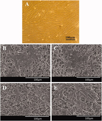 Figure 2. Optical micrographs of the dental pulp stem cells (DPSCs) (A), SEM images of the DPSCs-seeded electrospun PVDF scaffold in the absence (B) and presence of the PEMF exposure (ELF + PVDF) (C), DPSCs-seeded electrospun PVDF-PANI scaffold in the absence (D) and presence of the PEMF exposure (ELF + PVDF) (E) at day 14 while cultured under osteogenic medium.