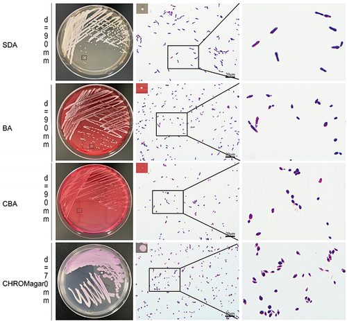 Figure 3 Morphologies of C. auris grown on Sabouraud (SDA), blood (BA), China blue (CBA) and CHROMagar Candida plates. The image on the right side shows a magnification of the image marked by a black rectangle.