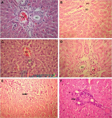 Figure 7 Histopathology picture of liver tissues with different treated groups (HE ×400).