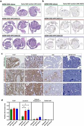 Figure 2. Large tubular adenomas developed in the AOM-DSS mice co-administrated with ST11 K. pneumoniae. Consecutive sections of Swiss colon rolls from individual mice were stained with Hematoxylin and Eosin (H&E), Alcian Blue (AB) Periodic Acid Schiff (PAS) for the detection of goblet cells, and were immunostained with Ki-67, β-catenin, and carbonic anhydrase (CA) II. Representative images of whole-mount sections analyzed by H&E stain (a) and Ki-67 IHC (b) are presented. (c) Representative images, analyzed by Ki-67, β-catenin, CAII IHC and AB-PAS stain, of the large adenomas developed in the AOM-DSS mice with and without KPC160111 or KPC160132 co-administration. (d) Positive rates of cells with positive signals against Ki67, β-catenin, and CA II and goblet cells were quantified by HistoQuest Software at a high-powered field in 5 randomly selected areas in each of the tumors or corresponding control regions. Data are presented as mean ± SD (n = 30 in each group). P values were determined by two‐tailed Student’s t-test between AOM‐DSS alone and AOM-DSS-KPC160111 or AOM-DSS-KPC160132. * P < .05