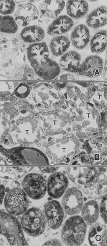 Figure 6. Morphological studies of pentoxifylline (PTX) effect on ischemic acute renal failure in rabbits. Samples were stained with hematoxylin-eosin. In control kidney (A), the proximal tubule shows normal structural appearance with plentiful brush border villi (arrows). In kidneys subjected to ischemia/reperfusion injury (B), brush borders of proximal tubule (T) were destructed. However, when kidneys were subjected to ischemia/reperfusion after PTX pretreatment (C), brush borders (arrows) of proximal tubule were regularly arranged as in control. Magnitude × 132.