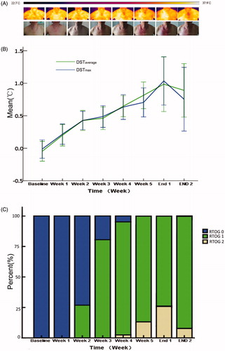 Figure 2. The correlation of the difference of skin temperature and dermatitis score. (A) A representative case with thermography and photograph every week. The color was a presentation of the surface temperature in thermography from 22.7 to 37.9 °C. (B) DST gradually increased with the progress of radiotherapy and peaked at the first week after the end of radiotherapy. (C) With the progress of radiotherapy, the RSI became more severe. The proportion of RSI Grade 2 was the highest at 1 week after the end of radiotherapy. Combined with the above three parts, it can be intuitively found that the severity of RSI is positively correlated with skin temperature changes.