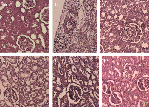 Figure 2.  Histological observation in renal sections (Hematoxylin and Eosin staining) of different experimental groups. (A) control, (B) toxic control (d-galactosamine, 500 mg/kg, i.p.), (C) standard (Silymarin, 100mg/kg), (D) B. nigra extract (200 mg/kg, p.o.) + d-galactosamine treated, (E) B. nigra extract (400 mg/kg, p.o.) + d-galactosamine treated and (F) B. nigra extract (400 mg/kg, p.o.) alone treated.