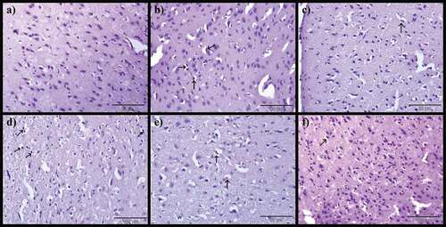 Figure 8. Photomicrographs of cerebrum: a) Control group, b) Model group, c) Donepezil, d) CA 200, e) CA 400 and f) CA 800. H & E stain, magnification 40x, n = 3. Precellular edema in the cerebral cortex (black arrows).
