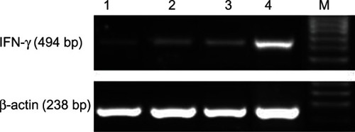 Figure 8 The expression of interferon (IFN)-γ secreted by T cells when co-cultured with dendritic cells (DCs).