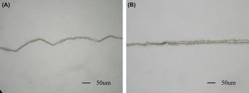 Figure 4. Myelinated nerve fiber isolated from the tibial nerve. A: single fiber isolated from the tibial nerve in sham control group; B: Regenerated fiber at the site of suture with biodegradable chitin conduits. A myelinated axon sprouts collateral branches at the node of Ranvier. (Observed with light microscopy working at 100× magnification).