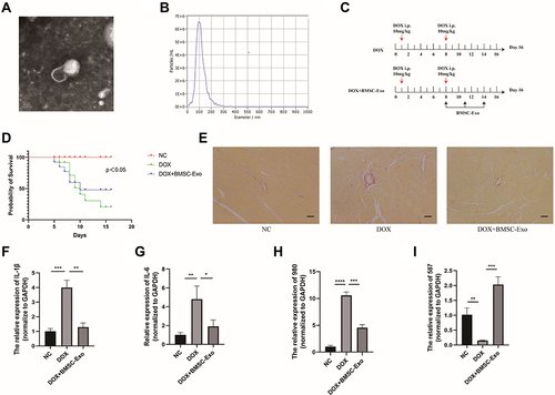 Figure 8 The verification experiments in vivo. (A) Exosomes photographed by transmission electron microscopy (TEM). (B) The nanoparticle diameter identified by NTA. (C) The schematic design of animal experiment. (D) The survival rate of different groups (p<0.05). (E) The Sirius Red Staining. (F) The relative expression of IL-1β. (G) The relative expression of IL-6 in each group. (H) The relative expression of MSTRG.58791.2 in each group. (I) The relative expression of MSTRG.98097.4 in each group. (*p < 0.05; **p < 0.01; ***p < 0.001; ****p < 0.0001).