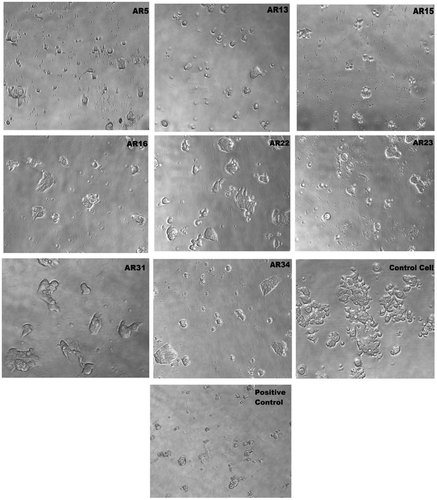 Figure 6. Microscopically images of HT-29 human colon cancer cell line on 80X with respect treatment of drugs (μM) was used, which are shown the GI50 inhibition such as AR5, AR13, AR15, AR16, AR22, AR23, AR31, AR34, and Control HT-29 cancer cell, positive control cell (Adriamycin), respectively.