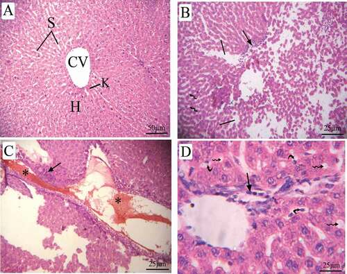 Figure 8. Photomicrographs of liver sections of pregnant dams (stained with H&E) obtained on the 20th day of gestation. (A) Control group: normal lobular architecture with regular arrangement of hepatocytes around a central vein. Hepatocytes and their nuclei and blood sinusoids are normal in shape. (B) LD group, (C, D) HD group: loss of hepatocyte architecture, wide sinusoids (lines), lymphatic infiltration (arrow), cytoplasmic vacuoles (wavy arrow). hemorrhage (asterus), apoptotic cells (curved arrow). H = hepatocytes, CV = central vein, S = sinusoids, and K = Kupffer cells