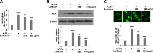 Figure 5 Lentinan inhibited AGE-induced iNOS expression and production of NO. Cells were stimulated with 100 μg/mL AGEs with or without lentinan (250 and 500 µg/mL) for 24 h. (A) mRNA of iNOS; (B) Protein of iNOS as measured by Western blot analysis; (C) Production of NO as measured by DAF-FM staining (****, P<0.0001 vs vehicle group; #, ##, ####, P<0.05, 0.01, 0.0001 vs AGEs treatment group, n=4-5).