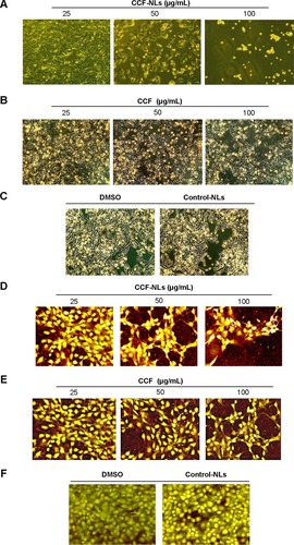 Figure 3 Morphology and viability of DBTRG cells.Notes: (A) CCF-NL-induced morphological changes. DBTRG-05MG glioblastoma cells were examined and photographed using phase-contrast microscopy (×400). (B) DBTRG-05MG glioblastoma cells treated with CCF for 24 h. (C) DBTRG-05MG cells treated with 0.1% DMSO and control-NL. (D–F) DBTRG-05MG glioblastoma cells were stained with HE to detect necrosis and apoptotic chromatin condensation. More than one field in each group were observed by fluorescence microscopy (×400), and representative images are shown.Abbreviations: CCF-NLs, Cotinus coggygria flavonoid nanoliposomes; CCF, Cotinus coggygria flavonoid; DMSO, dimethyl sulfoxide; NLs, nanoliposomes; h, hours.