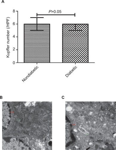 Figure 1 Quantification of Kupffer cells, mitochondria and endoplasmic reticulum in Kupffer cells in nondiabetic vs diabetic mice.