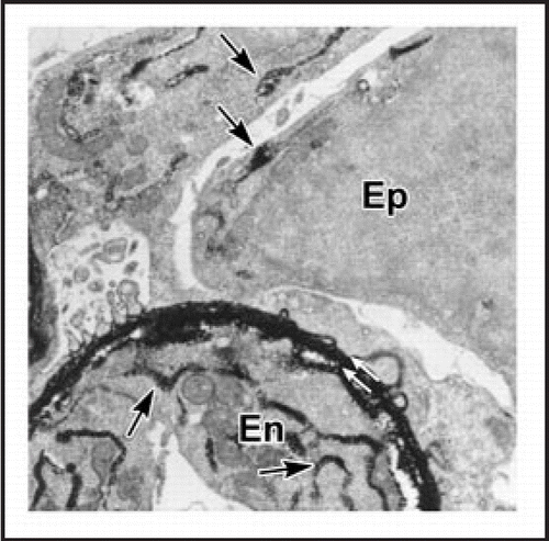 Figure 7 Electron microscopy of lightly fixed sections from newborn rat kidney incubated in vitro with anti-laminin IgG-HRP. Note HRP is present within double basement membrane (white arrows) and within biosynthetic apparatus (arrows) of the endothelium (En) and epithelium (Ep). Reproduced with permission (ref. Citation43).