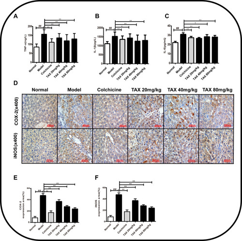 Figure 4 TAX-treatment attenuates CCl4-induced inflammation injury. (A–C) TAX effect on countenance of TNF-α, IL-1β, and IL-6 in mice serum. (D) Immunohistochemical staining of COX-2 and iNOS inflammatory factors in liver tissue. (E and F) Inflammatory cell expression area %Data are presented as the mean±SD (n=10). As compared with the normal group, #P<0.05 indicates a significant difference, ##P<0.01 indicates a extremely significant difference; As compared with the model group, *P<0.05 indicates a significant difference, **P<0.01 indicates an extremely significant difference.