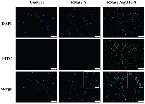 Figure 5 The cellular uptake of free FITC-labeled RNase A and FITC-RNase A@ZIF-8 nanoparticles. The images were acquired with 10 × magnification (scale bar: 100 μm), and the enlarged ones were obtained with 40 × magnification (scale bar: 20 μm).