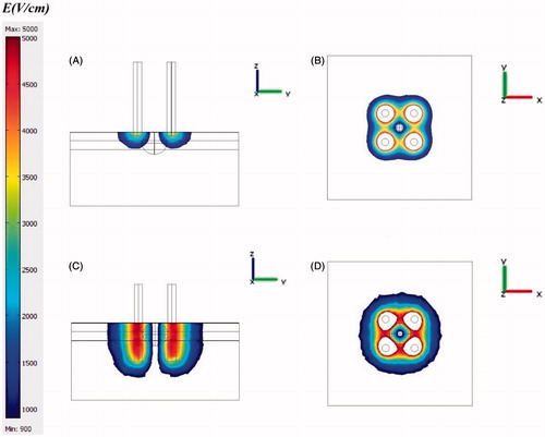 Figure 10. The effect of electrode insertion on electric distribution in tumour and normal tissue for 4-electrode configuration. (A) i = 0.5 mm, y–z view, (B) i = 0.5, x–y view, (C) i = 5 mm, y–z view, (D) i = 5 mm, x–y view. The effect of electrode insertion on irreversibly electroporated volume is obvious especially on normal tissue.