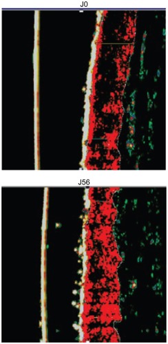 Figure 4 Dermal redensifying effect of the 1% of honokiol preparation at day 0 and day 56.
