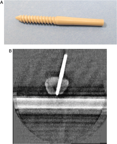 Figure 4. A) Schanz screw made of polyether-ether-ketone (PEEK). B) Iso-C3D scan of the PEEK Schanz screw, with no artifacts visible. The screw is well defined from the synthetic bone.