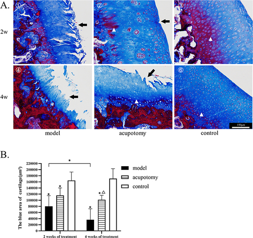 Figure 4 (A) 1–6: Masson staining. The black arrow points to cartilage damage, the triangle marks the position of the tide line. All pictures use the scale in the image ⑥. (B) Quantitative analysis of the blue staining area of Masson staining shows that more cartilage was preserved in the acupotomy group after 4 weeks of treatment, the model group lost more cartilage over time. Compared with the control group during the same time period, *P is < 0.05; Compared with the model group during the same time period, ΔP is < 0.05.