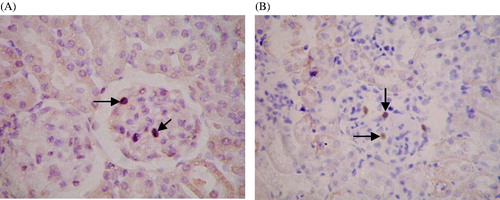Figure 2. Growth of exogenous mesangial cells in the rat kidney. Paraffin sections of renal tissue in the BC and AM groups were detected by in situ hybridization. The distribution of cells with positive expression of the neor gene was mainly in the glomeruli. There was no expression of positive cells in kidney tubules, renal interstitium, or blood vessels. ISH ×400. (A) BC group; (B) AM group. Black arrows indicate positive cells expressing the neor gene.