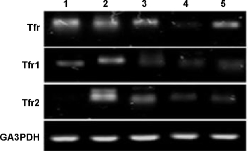 Figure S6 Agarose gel images of the Q-RT-PCR (quantitative real time polymerase chain reaction) of TfR and its isoforms.Abbreviation: TfR, transferrin receptor.