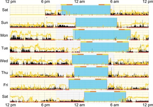 Figure 2 Actigram from a participant working day shifts (7 am–7 pm).