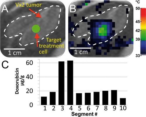 Figure 8. Demonstration of heterogeneous drug delivery. (A) VX2 tumour was clearly identified (white dashed line) on the proton density-weighted planning images and a target region within the tumour was chosen (green circle). (B) Temperature maps (colour scale) overlaid on planning images (greyscale) during a mild hyperthermia treatment with a 4 mm treatment cell, showing typical temperature distribution after 1 min of heating. (C) Doxorubicin concentration in tumour segments was determined by HPLC. Note the higher drug concentration in segments 3 and 4.